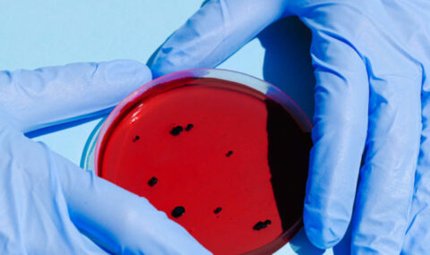 person-holding-petri-dish-3786217-scaled-770x400