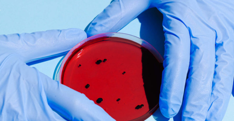 person-holding-petri-dish-3786217-scaled-770x400